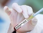 Premieră - NATO se implică financiar într-o companie de biotehnologie