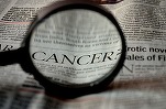 Cancerul, principala cauză de deces în rândul persoanelor de vârstă mijlocie din țările cu venituri mari pe cap de locuitor
