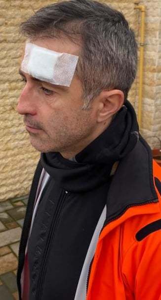 FOTO Europarlamentarul Dragoș Benea, rănit după ce a intrat cu bicicleta într-un autoturism