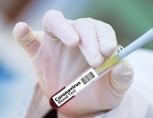 Alte 9.685 de cazuri de infectare cu noul coronavirus. S-au înregistrat 160 de decese