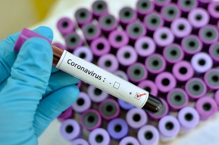 UPDATE - Al 49 - lea caz de coronavirus diagnosticat în România