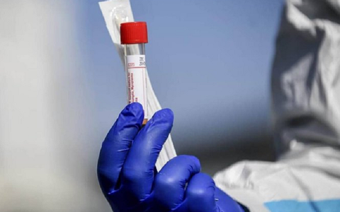 Zece focare de infectare cu noul coronavirus sunt active în judeţul Buzău