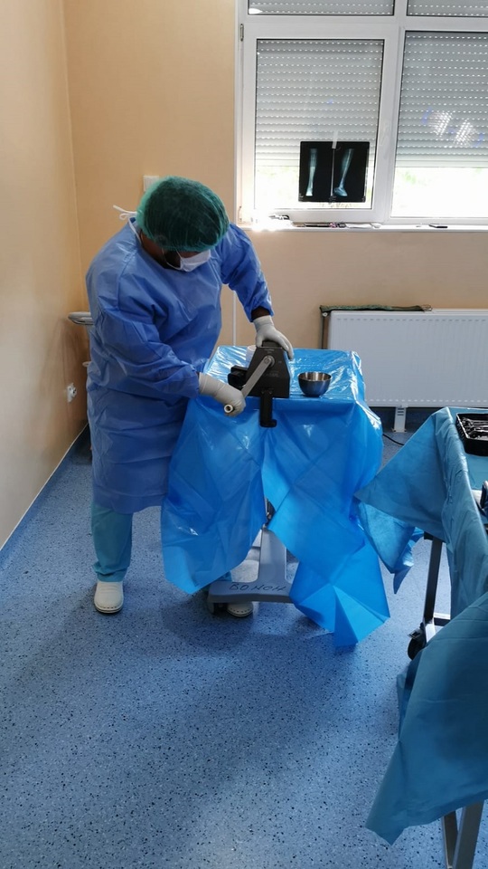 FOTO: Medicii pregătesc grefa de os care va înlocui cimentul montat de medici în zona în care a fost tumora
