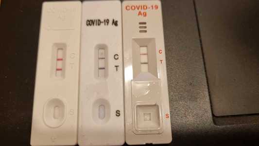 Sorin Cîmpeanu: 8.005 teste de salivă pozitive, în săptămâna 31 ianuarie - 4 februarie, 56,11% confirmate RT-PCR 