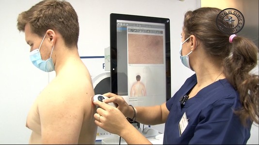 Inteligenţa Artificială, folosită în cabinetul de dermatologie al Spitalului CF Timişoara pentru depistarea precoce a cancerului de piele