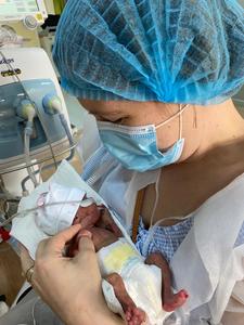 Ziua Mondială a Prematurităţii - Cel mai mic prematur născut la Spitalul Universitar de Urgenţă Bucureşti a cântărit sub 500 de grame