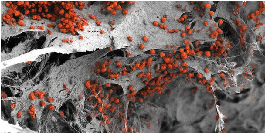 Modelul de măduvă osoasă creat în laborator deschide noi perspective pentru testarea tratamentelor