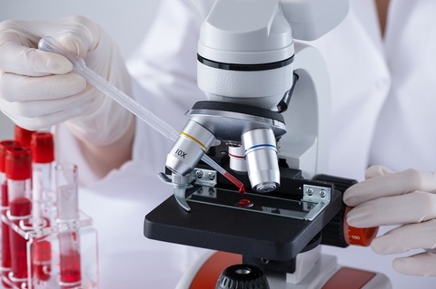 Un sistem cu ţesuturi umane permite urmărirea metastazelor cancerului de sân în plămâni şi la nivel osos