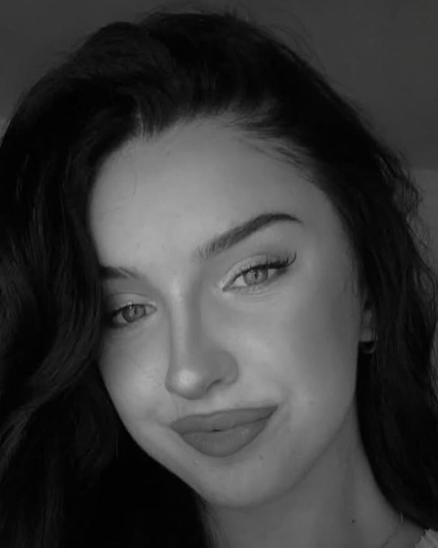 Miss Austria a murit la vârsta de 22 de ani, după ce a suferit şapte operaţii pe cord deschis