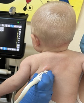 Medic pneumolog pediatric din Timişoara: Folosirea inteligenţei artificiale în ecografia pulmonară nu înseamnă mai puţină implicare a medicului