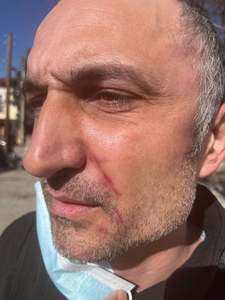 Dolj: USR acuză că un membru USR Breasta a fost agresat fizic de „acoliţii” primarului PSD al comunei