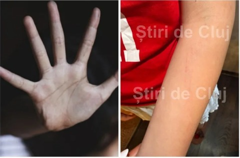 Cluj: Anchetă a Poliţiei după ce o tânără care a participat balul de absolvire a liceului a ajuns la spital, reclamând că a fost violată. Reprezentanţii unităţii de primiri urgenţe au anunţat autorităţile