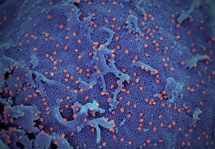Cercetătorii de la Hong Kong au publicat o nouă imagine a virusului la microscop. Cazurile de infectare cu coronavirus în Coreea de Sud s-au dublat în ultimele 24 de ore