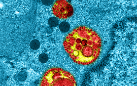Institutul Naţional francez de Sănătate şi Cercetare Medicală publică o imagine a unei celule infectate cu SARS Cov-2