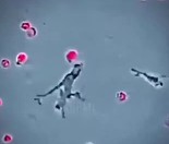Un turist care a tranzitat Franţa în a doua jumătate a lunii iulie a fost testat pozitiv la tulpina Andes de hantavirus, în timp ce franţuzoaica infectată cu hantavirus în epidemia din primăvară a ieşit din terapie intensivă după trei luni