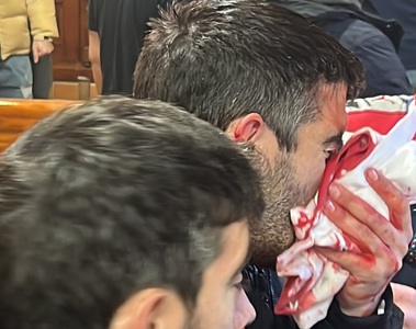 Un suporter, rănit în violenţele dinaintea meciului Athletic Bilbao - Atletico Madrid