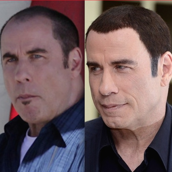 Ce actori de la Hollywood şi-au făcut transplant de păr? 