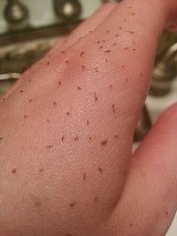 Metoda CONTROVERSATA care iti scoate punctele negre din piele! Functioneaza garantat la toata lumea!