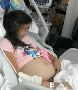 Burta acestei fetite de 11 ani crestea, iar toata lumea credea ca e gravida! Medicii au ramas socati cand i-au facut o ecografie. Ce au gasit in abdomenul ei