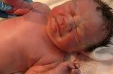A ramas din nou gravida, desi nu voia. La cezariana, medicii au ramas cu gura cascata: "Doamna, in afara de copil mai e ceva aici" Ce au gasit in uterul femeii