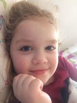 Teodora, o fetita care sufera de nev congenital gigant, are nevoie de ajutor! Boala ei e extrem de rara si pana la 8 ani are nevoie de mai multe operatii