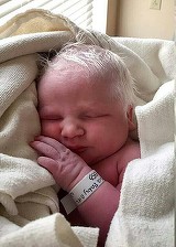 E unica in lume! Medicilor si parintilor nu le-a venit sa creada cu ce s-a nascut pe cap! Fotografiile au devenit imediat virale