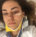 Noi detalii despre starea Mirei, solista trupei DJ Project! Ce au descoperit medicii de la Urgenta la un control amanuntit! Mama artistei: "O doare"