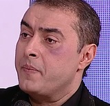 Imagini socante cu Marian Mexicanu'! A fost snopit in bataie: "Am fost la un eveniment si cineva mi-a cautat nod in papura pentru bani"