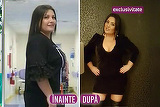 Bianca Rus a slabit 11 kilograme in doua luni, dupa ce si-a taiat stomacul! "Mai trebuie sa dau jos 24 de kilograme"