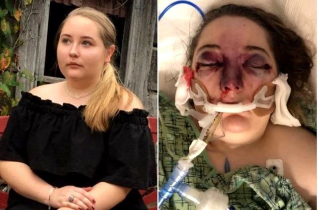 A orbit după ce s-a întors din vacanţă! Povestea tragică a unei adolescente de 15 ani