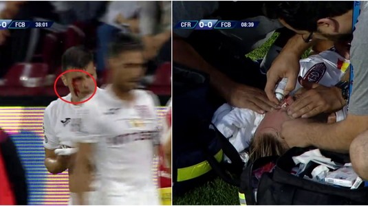 VIDEO | Dueluri extrem de dure în CFR - FC Botoşani. Ţucudean şi-a ieşit din minţi când a văzut că şi-a spart arcada