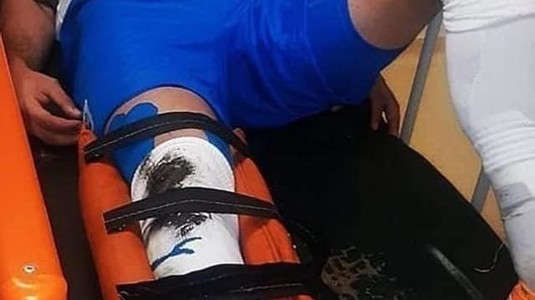 FOTO | Aşa arată fractura suferită de Elvir Koljic. Imaginile dure ale accidentării grave a bosniacului