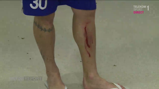VIDEO EXCLUSIV | Liga I a început în 2018 cu o accidentare teribilă! ”Şeroni are piciorul plin de sânge. Brutalitatea e la ea acasă”