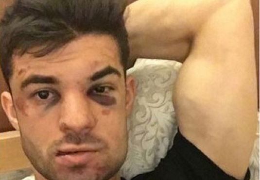 FOTO ŞOCANT | Un fotbalist  a fost bătut crunt după ce a parcat pe locul altcuiva