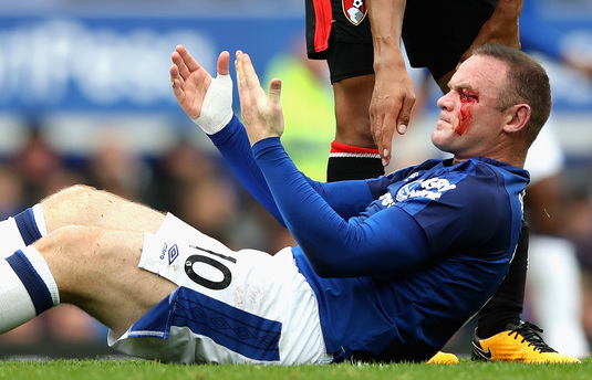 FOTO | Imagini de coşmar cu Wayne Rooney! Atacantul lui Everton arată mai rău decât Rocky, după un duel cu un adversar