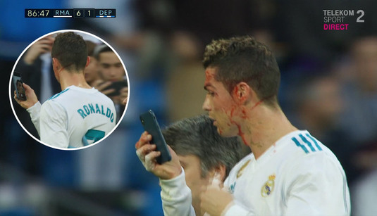 VIDEO INCREDIBIL | Ce a făcut Ronaldo în momentul în care a fost umplut de sânge de un adversar: le-a cerut medicilor un telefon