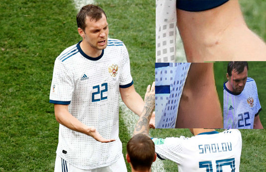 FOTO | ”Oare de la ce sunt acele semne?!”. Scandal pe internet, după o fotografie controversată cu un fotbalist rus