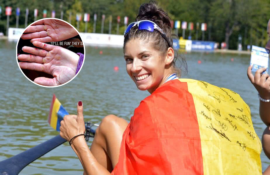 FOTO IMPRESIONANT | Cum arată palmele unei campioane mondiale! Imagine dureroasă postată pe net