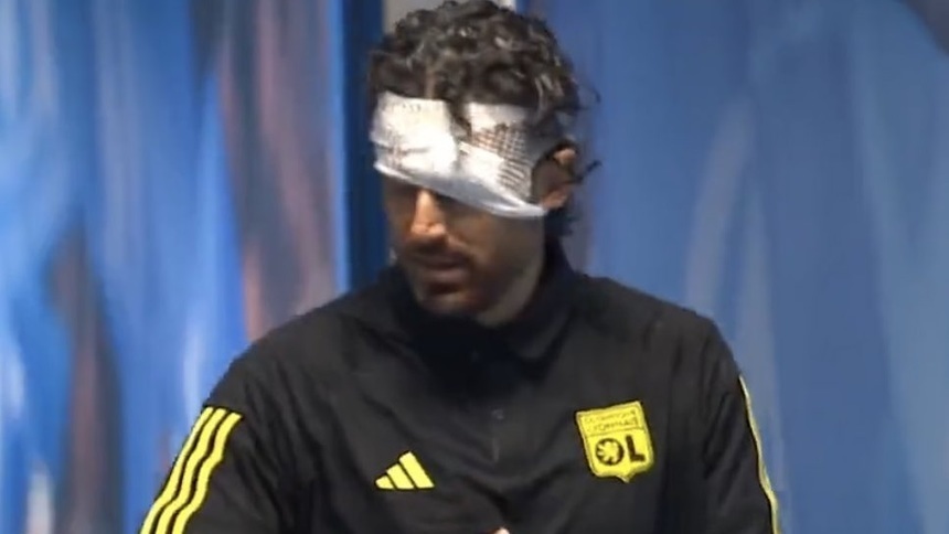 Fabio Grosso, după incidentele de la meciul cu Olympique Marseille. ”Am impresia că autocarul nu ar fi trebuit să facă acest traseu”