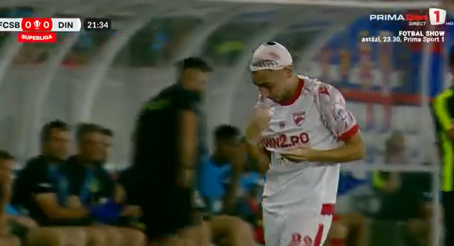 Ahmed Bani a ieşit serios şifonat din derby-ul cu FCSB
