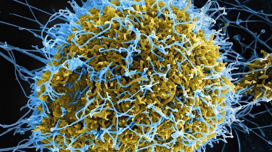//i0.1616.ro/media/581/3142/41227/22474762/1/ebola.jpg
