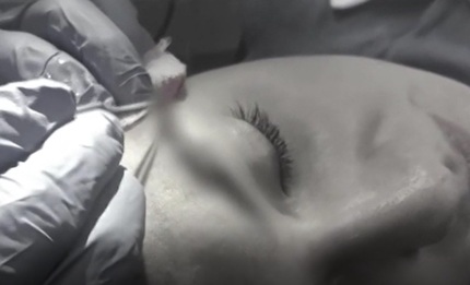 Hai cu fetele - Felix Popescu dezvăluie tainele implantului de sprâncene