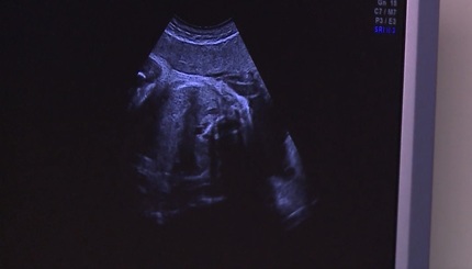 Sănătate cu stil: Nu neglijaţi sarcina de teama COVID-19