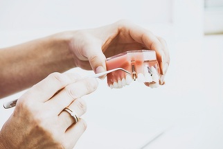 Stomatologii vor educaţie pentru sănătatea orală în licee. Două treimi dintre copii au carii dentare