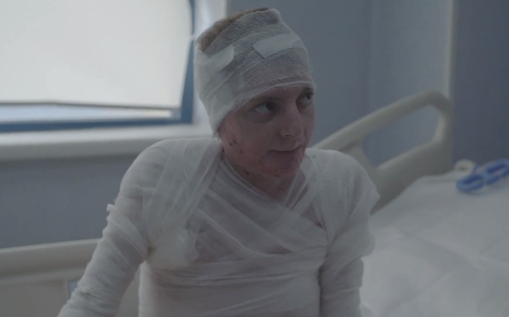 VIDEO. Campanie umanitară lansată de un supravieţuitor Colectiv şi familia unei victime: Fonduri pentru o fată de 17 ani, care a suferit arsuri grave