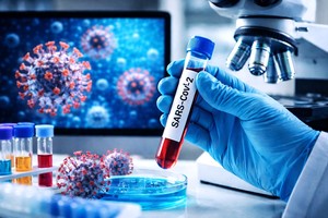 O nouă variantă SARS-CoV-2 monitorizată la nivel internaţional ridică semne de întrebare privind protecţia vaccinurilor. Varianta a fost identificată până acum în 23 de ţări