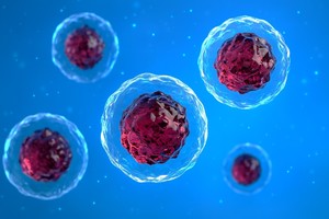 Cum devin celulele canceroase „nemuritoare”? Cercetătorii au identificat un mecanism celular care ar putea creşte eficienţa chimioterapiei şi reduce efectele adverse