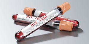 Testarea pentru HIV şi hepatite rămâne insuficientă în UE, avertizează Centrul European pentru Prevenirea şi Controlul Bolilor
