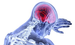 29 octombrie - Ziua mondială a accidentului vascular cerebral