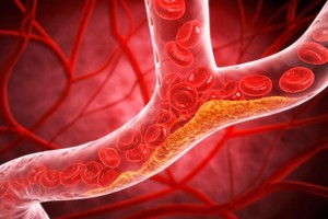 O intervenţie alimentară de doar 48 de ore, poate reduce semnificativ colesterolul nociv, arată un studiu